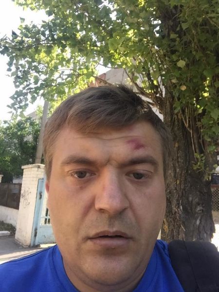 Сергей Никитенко после избиения