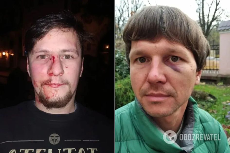 Львовские херои Донбасса отхватили от полиции