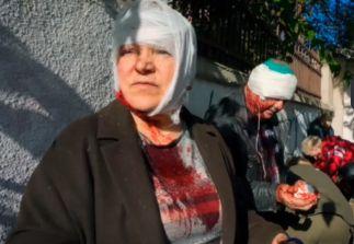 Как киевский режим клепает фейки про "жертв русских обстрелов" для западных газет